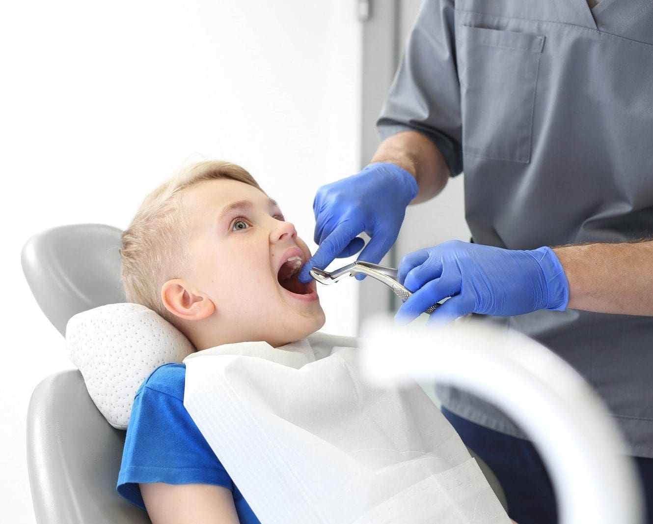 Tooth Extractions