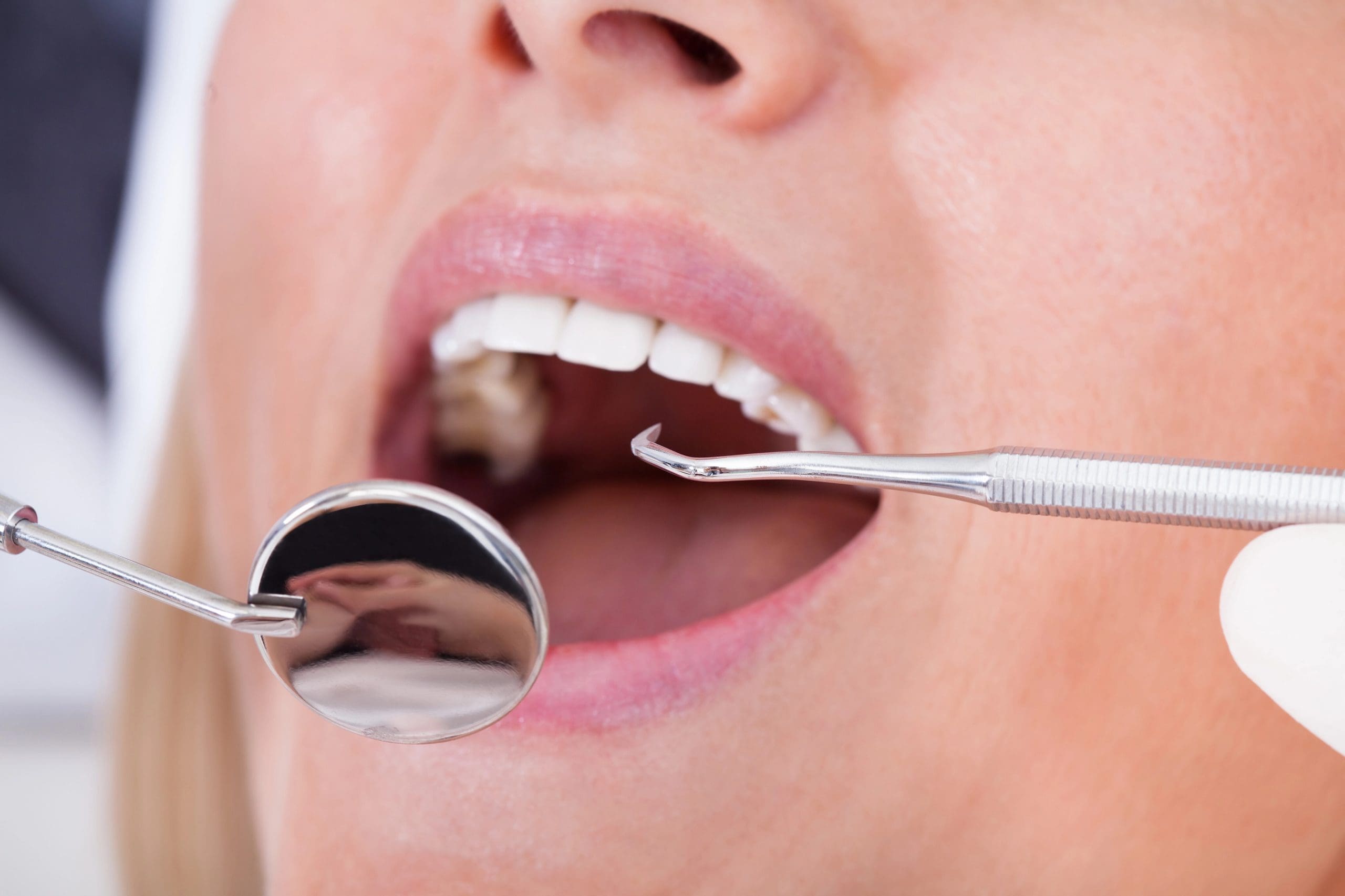 Dental Implant Recovery: Key Steps Explained